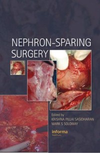 Image of Nephron Sparing Surgery