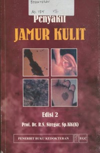 Image of Penyakit Jamur Kulit